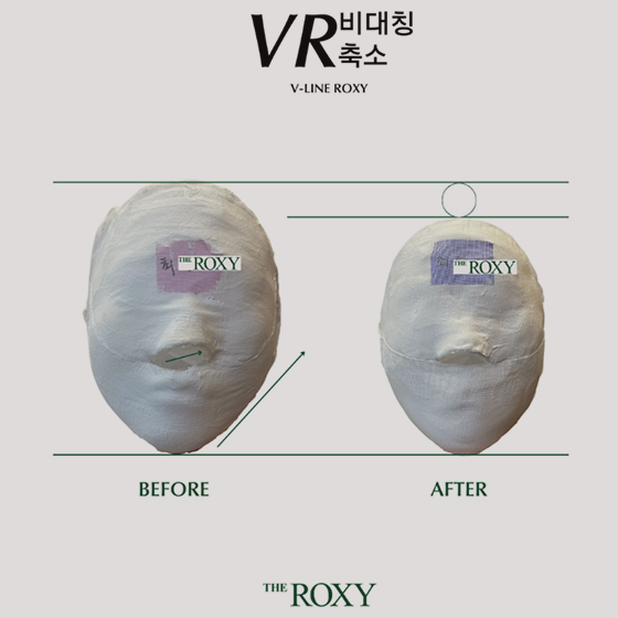 전후 석고상